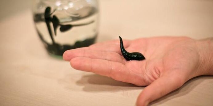 Leeches